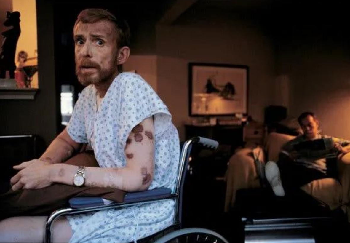 从感染到死亡：艾滋病发病的全过程记录！