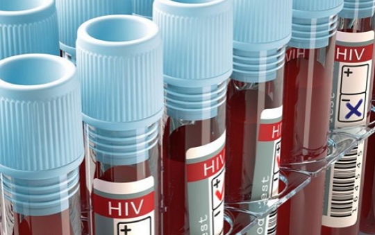 除了验血，检测HIV还有更简单的方法？
