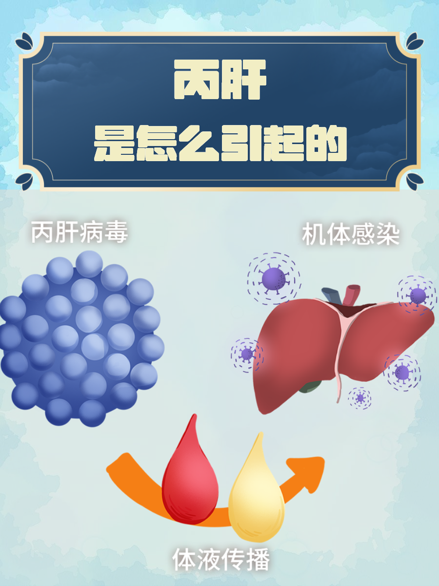 科普 | 发现即是晚期，丙肝要你命可不手软！