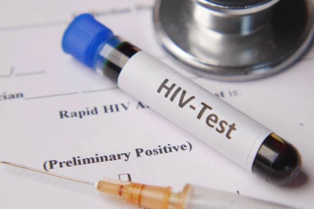 【双语】HIV病毒“检测不到”是指什么？ ئەيدىز ۋىرۇسىنى «تەكشۈرۇپ چىققىلى بولماسلىق» دېگەن نېمىنى كۆرسىتىدۇ؟