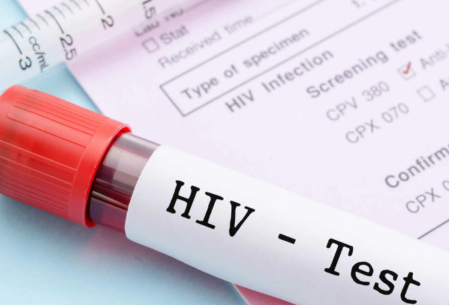 警钟！研究证实：晚治患者体内HIV病毒库普遍“抗体耐药”