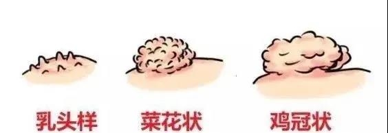 微信图片_菜花1.jpg