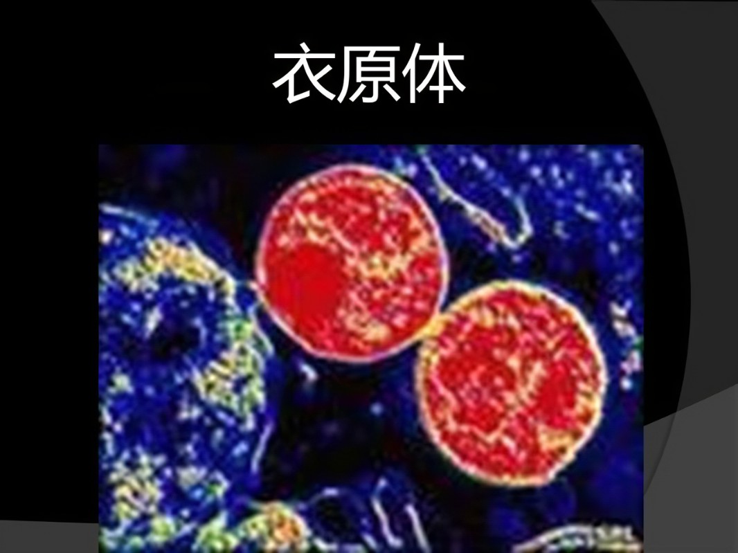 R-C衣原体2.jpg