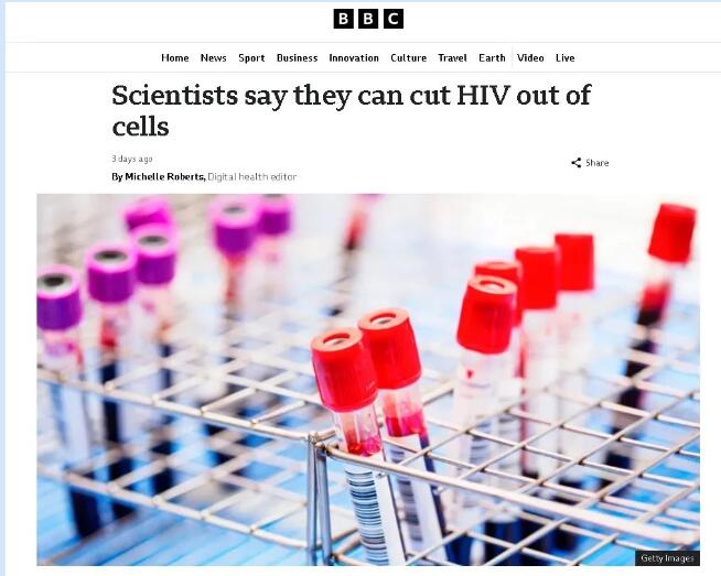 BBC专题：科学家表示可从细胞中切除HIV，治愈HIV取得突破！