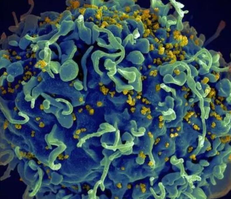 非洲新检测法助力全球HIV治愈研究
