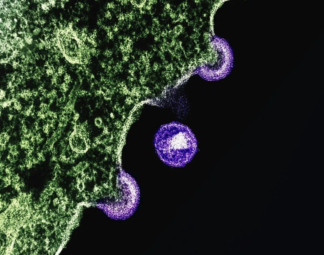“HIV离体瞬间失去传染性”，“瞬间”究竟是多长时间？