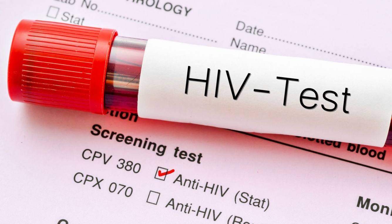 什么是HIV急性感染？