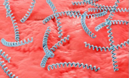 【双语】健康科普：正确认识梅毒  　　ساغلاملىقنى ئومۇملاشتۇرۇش: سىفلىسنى توغرا تونۇش