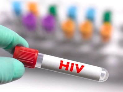【双语】HIV在体外能活多久？这些常识你需要了解  ئەيدىز كېسىلى بەدەن سىرتىدا قانچىلىك ياشىيالايدۇ ؟ بۇ ساۋاتلارنى سىز چۈشىن